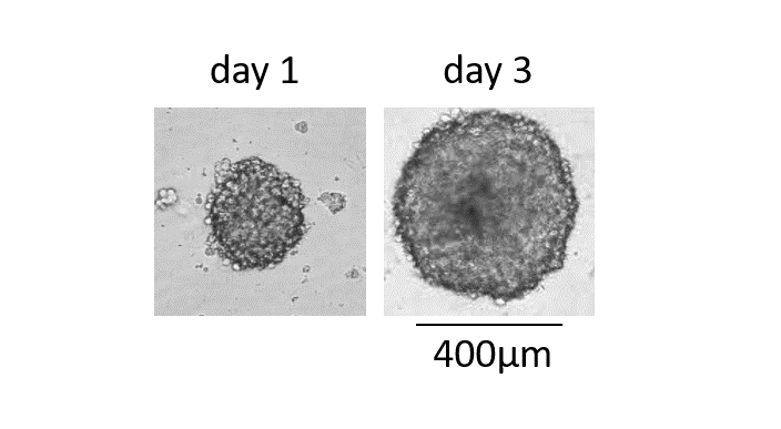 3d Tumor spheroids grown for 3 days derived of U87 cell culture
