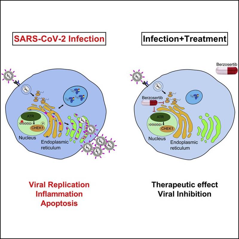 ATR inhibitor berzosertib exhibits potent inhibition of SARS-CoV-2 replication at a post-entry step