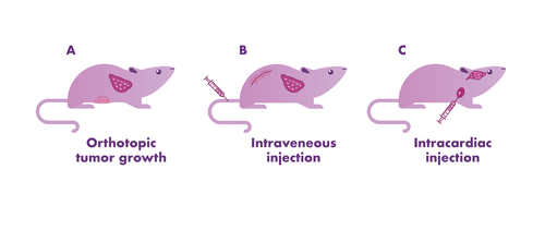 Metastasis routes of implantation