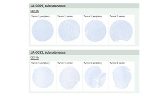 Tumor Microarray Gallery